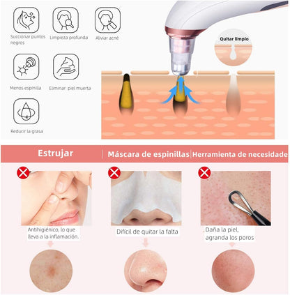 VivaSkin – Extractor de Impurezas Facial Profesional